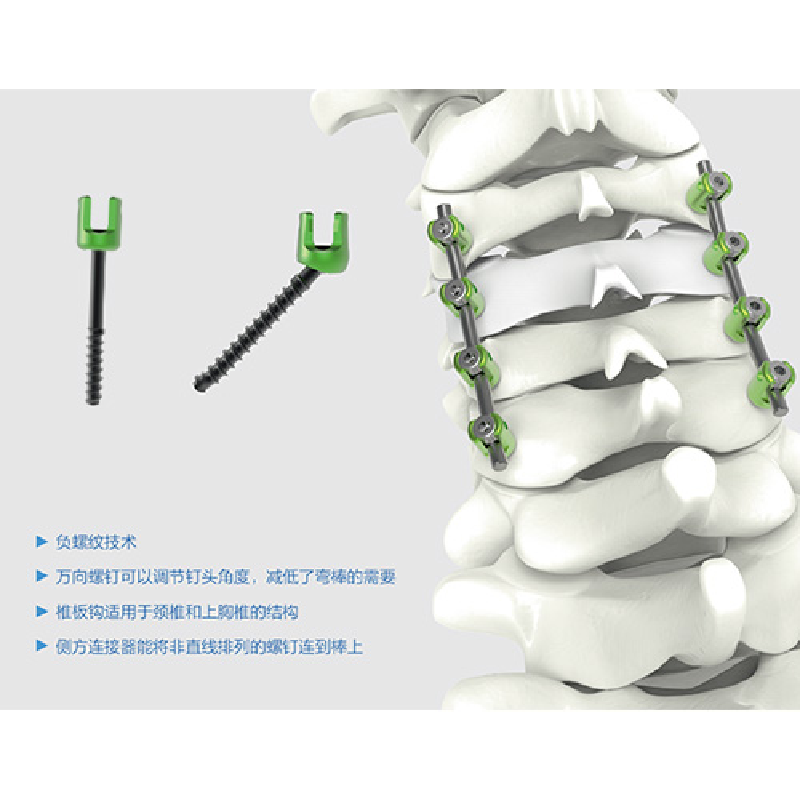 PCF Posterior Cervical Internal Fixation System