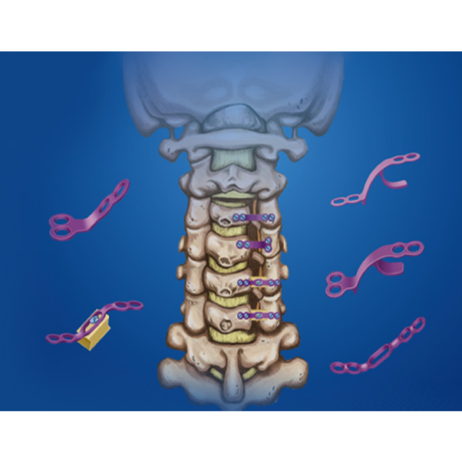 Working Principles of Key Diagnostic Imaging Equipment Explained