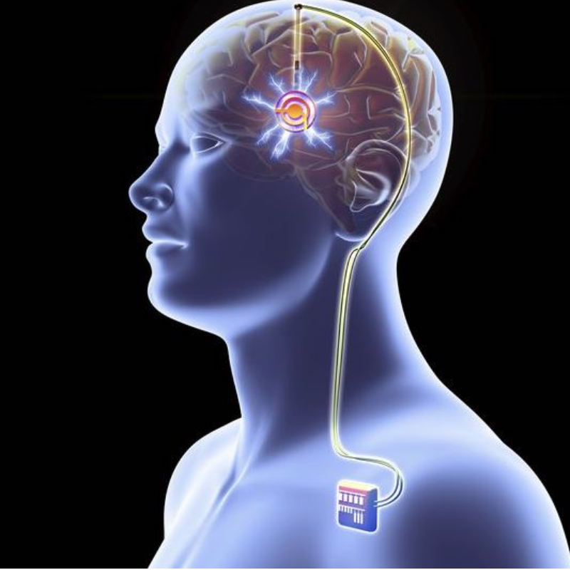 Neuromodulation Stimulation and BCI for Addiction Treatment